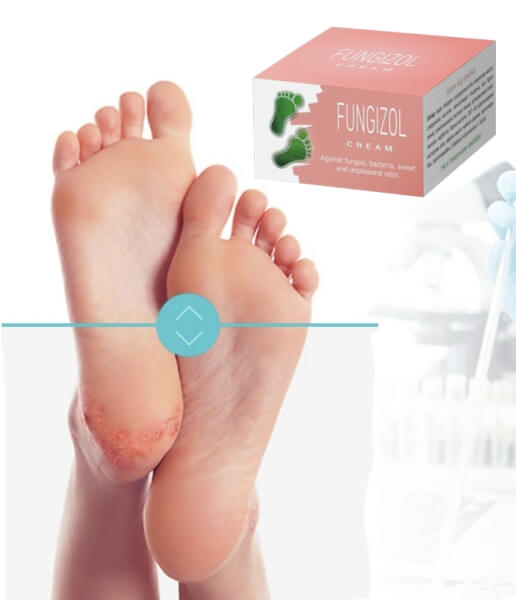 Mis on Fungizol ja kuidas see toimib?